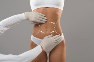 Body Sculpting Treatments in Oklahoma City, OK | H-MD Medical Spa